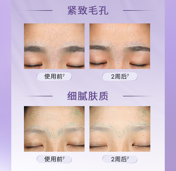 兰芝精研光凝盈亮精华面膜